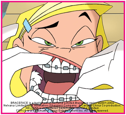 braceface2